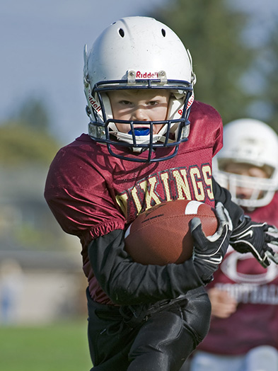 mouthguards